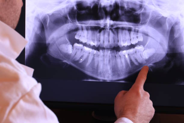 Best Emergency Dental Surgery in Hasbrouck Heights, NJ